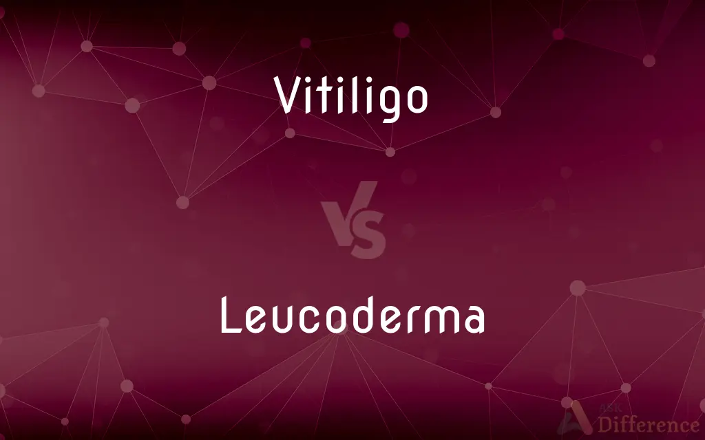 Vitiligo vs. Leucoderma — What's the Difference?